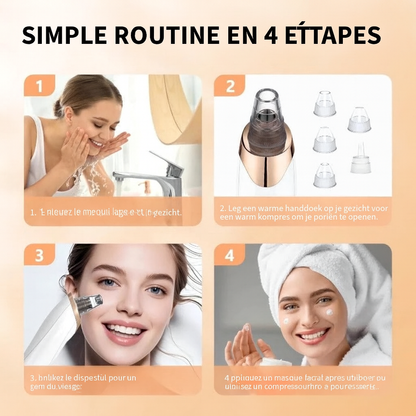 Extracteur Professionnel de Points Noirs
