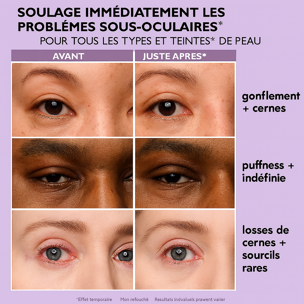 Peter Thomas Roth Instant FirmX – Soin tenseur instantané et temporaire pour le contour des yeux