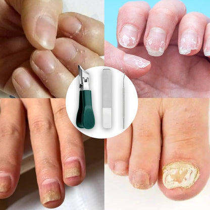 Pince à ongles professionnelle pour ongles incarnés et épais – Design en bec d'aigle