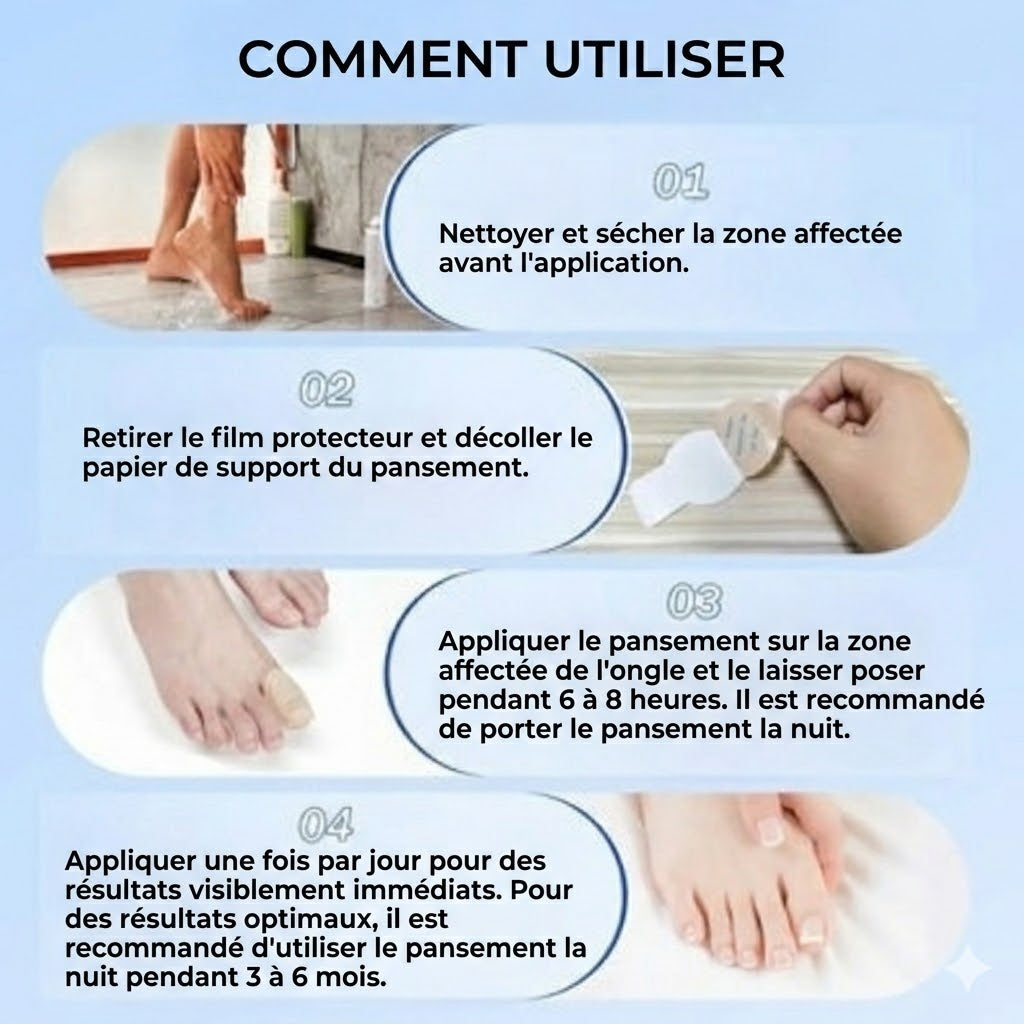 FungalPatch – Kit de Soin Intensif des Ongles – Patchs Antifongiques Auto-adhésifs