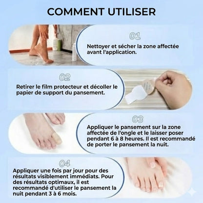 FungalPatch – Kit de Soin Intensif des Ongles – Patchs Antifongiques Auto-adhésifs