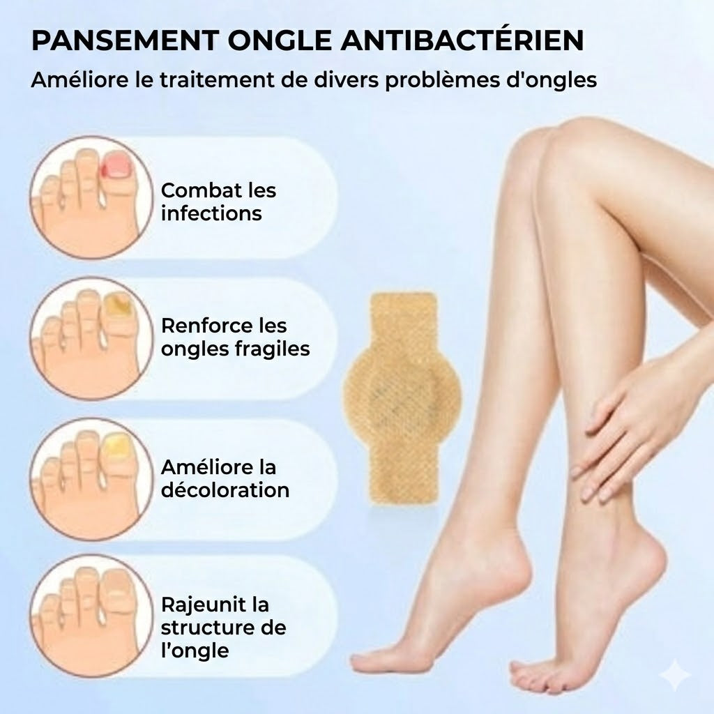 FungalPatch – Kit de Soin Intensif des Ongles – Patchs Antifongiques Auto-adhésifs