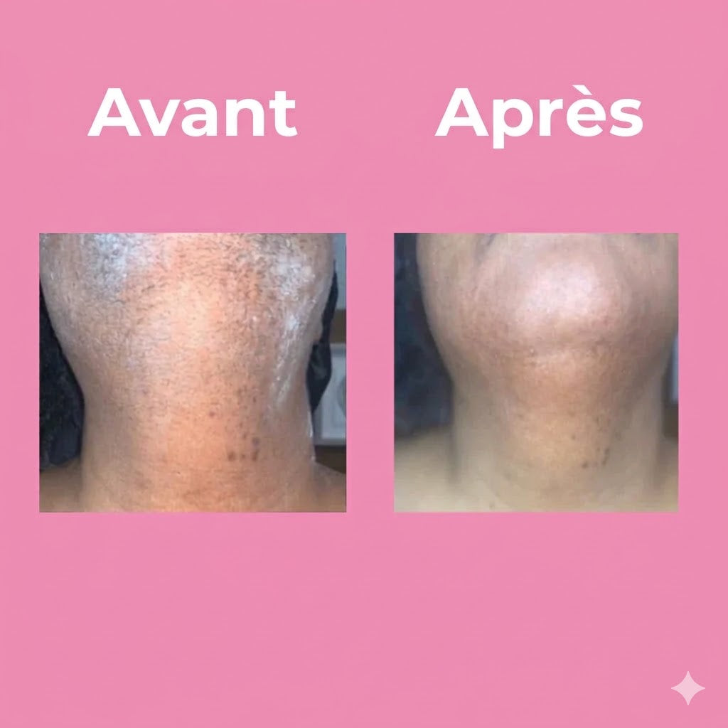 Crème dépilatoire professionnelle unisexe