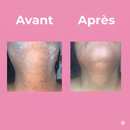 Crème dépilatoire professionnelle unisexe
